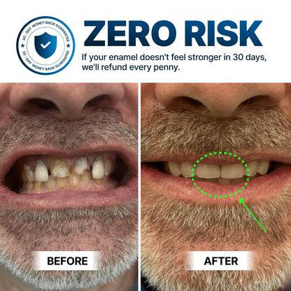Lumi Dentite Teeth Repair